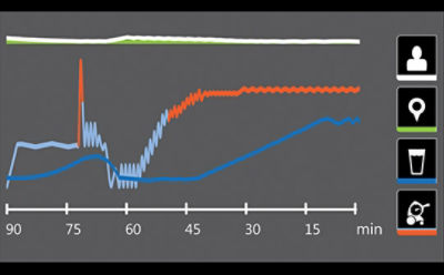Simulación de la pantalla de Altrix de Stryker donde se muestra la gráfica de la temperatura de un paciente, la temperatura objetivo y la temperatura del agua. 