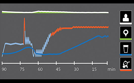 Simulação do ecrã Altrix da Stryker com um gráfico que indica a temperatura do paciente, a temperatura alvo e a temperatura alvo. 
