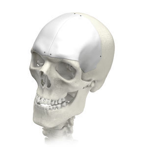 1492717142_CMF_skull_F_