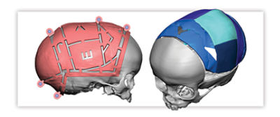 1500578553_VSP-Cranial-hero