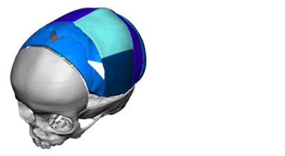 3D model skull