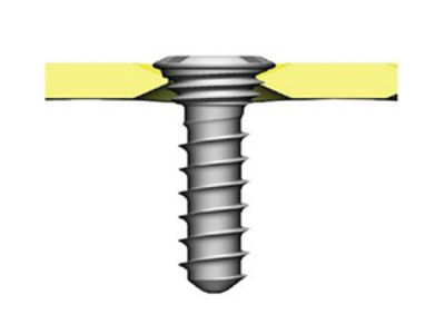 1594999916_Advanced-MidFace_-Anodization