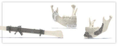 VSP guides product