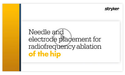 Dr. Akhil Chhatre of Johns Hopkins describes how to utilize the Stryker Venom cannula and electrode system for the treatment of hip pain