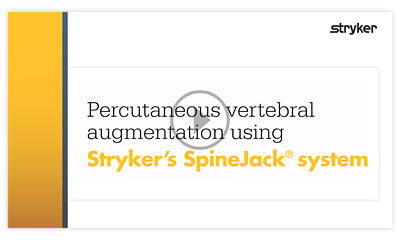 Dr. Khalil discusses bipedicular vertebral augmentation using Stryker's SpineJack system