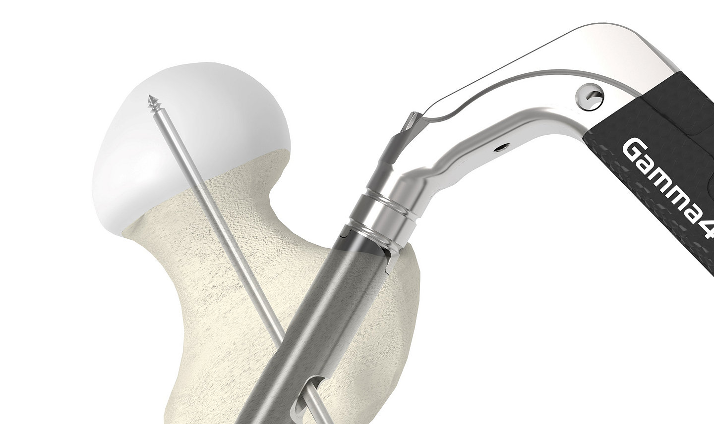 Gamma4 Hip Fracture Nailing System Precision
