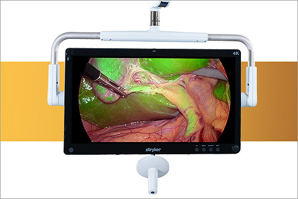Universal Display Mount, UDM, Surgical Display, Surgical Monitor