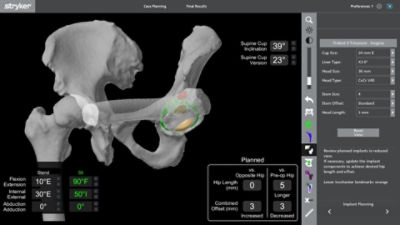 Virtual range-of-motion planning on Mako planning screen