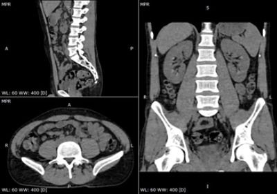 ABDOMEN PELVIS