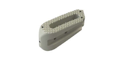 RISE®-L AL is an adjustable lordotic lateral lumbar interbody