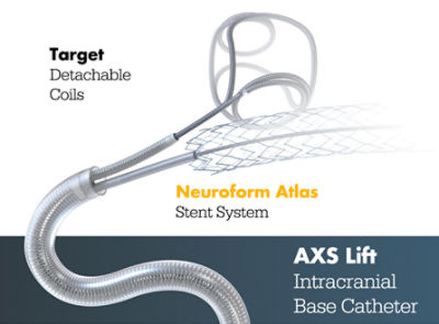 AXS Lift with Target Detachable Coils and Neuroform Atlas Stent System