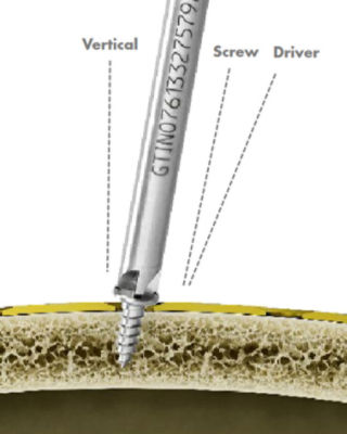 AXS-technology-definition-v1