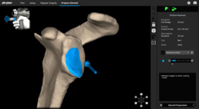 Accustop Screen Mako Shoulder