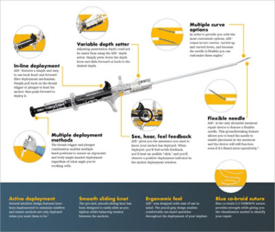 AIR+ All-Inside Repair | Stryker