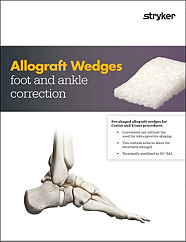 Allograft Wedges foot and ankle correction