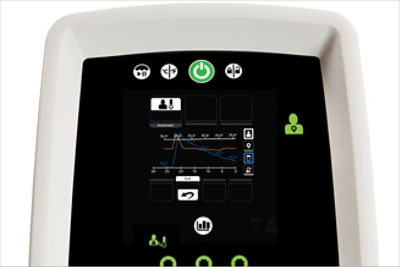 Altrix screen with patient graph