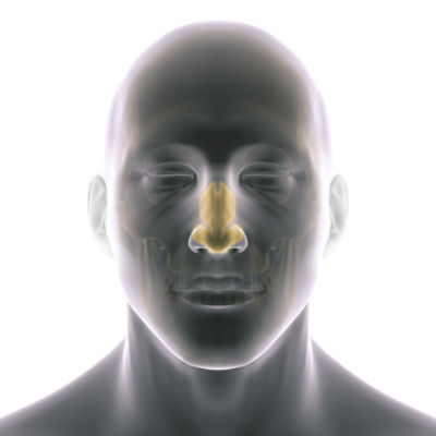 Nasal airway obstruction