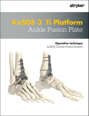 AxSOS 3 Ankle Fusion Operative Technique