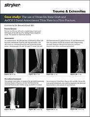 Vitoss BA: Pilon Fracture w/ AxSOS 3 Distal Anterolateral Tibia Plate