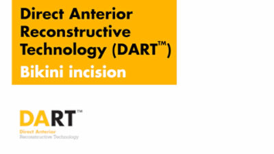Bikini Incision for Direct Anterior Reconstructive Technique (DART™) Total Hip Arthroplasty