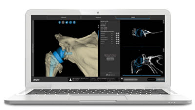 Mako Shoulder Screen