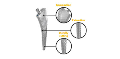 Insignia Tri-Stage broach cutting teeth