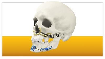 CMF-categories-Orthognathic