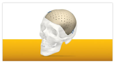 Cranial iD