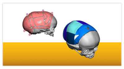 VSP Cranial