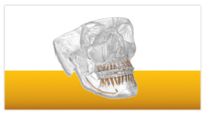 VSP Orthognathics