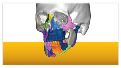 VSP Trauma