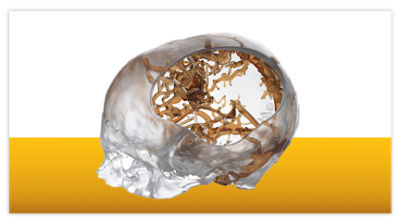 Anatomical models