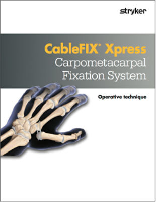 CableFIX Xpress Carpometacarpal Fixation System operative technique