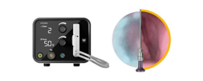 Hydro scope