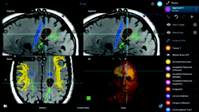 Cranial Guidance Software