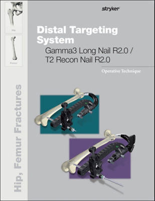 Distal Targeting System Gamma3 Long Nail R2.0 / T2 Recon Nail R2.0 Operative Technique