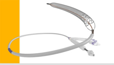 Deep Vein Thrombosis