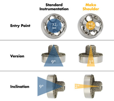 Deviation from Preoperative Plan Mako Shoulder
