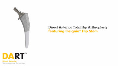 Direct Anterior Approach for Primary THA featuring Insignia®