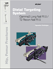 Distal Targeting System Gamma3 Long Nail R1.5/T2 Recon Nail1.5 operative technique