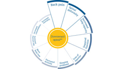 Left untreated, patients can face long-term complications known as the “downward spiral”