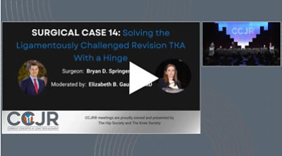 Solving the ligamentously challenged revision TKA with a Hinge thumbnail