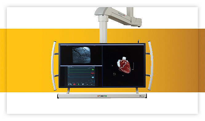 iSuite diagnostic 4K large monitor systems