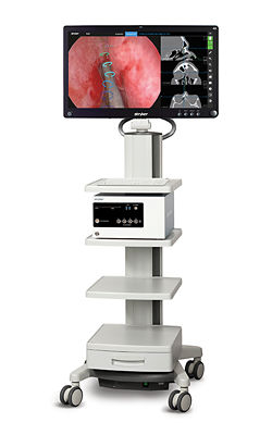 ENT Stryker Navigation System
