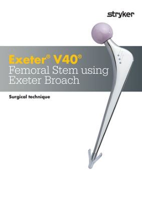 Exeter surgical technique (EXETER-SP-6_Rev-4_17192)
