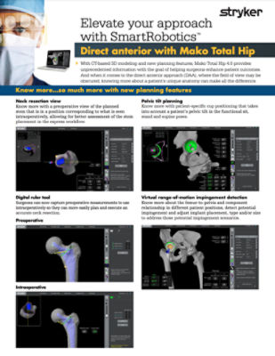 Elevate your approach with SmartRobotics™, Direct anterior with Mako Total Hip