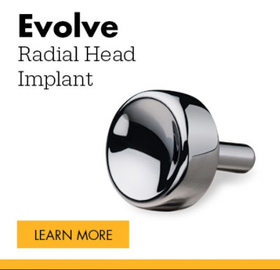 Evolve