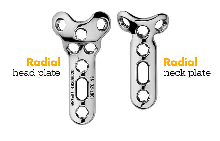 Evolve Triad Radial Head and Neck Plates