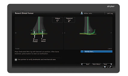Ortho Guidance express knee software