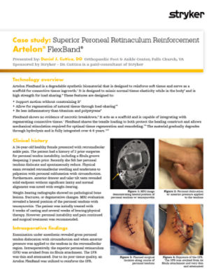 Case study: Superior Peroneal Retinaculum…